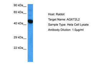 PHYKPL Rabbit Polyclonal Antibody