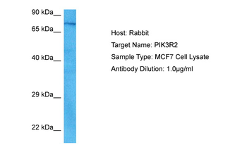 PIK3R2 Rabbit Polyclonal Antibody