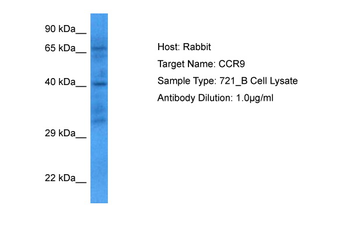 CCR9 Rabbit Polyclonal Antibody