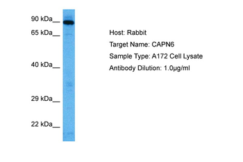CAPN6 Rabbit Polyclonal Antibody