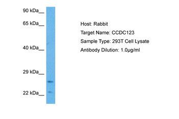 CEP89 Rabbit Polyclonal Antibody