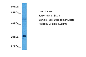 SDC1 Rabbit Polyclonal Antibody