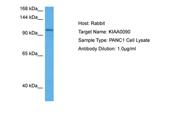 EMC1 Rabbit Polyclonal Antibody