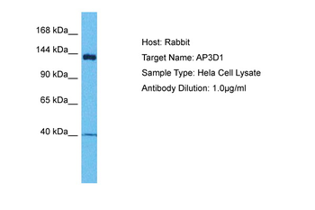 AP3D1 Rabbit Polyclonal Antibody