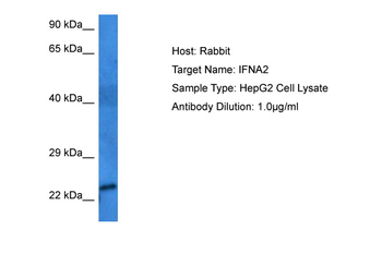 IFNA2 Rabbit Polyclonal Antibody