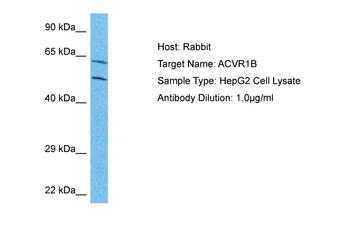 ACVR1B Rabbit Polyclonal Antibody