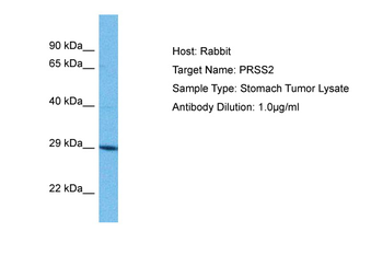 PRSS2 Rabbit Polyclonal Antibody