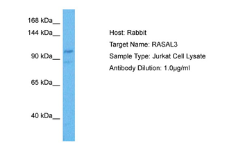 RASAL3 Rabbit Polyclonal Antibody