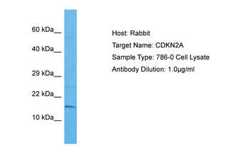 CDKN2A Rabbit Polyclonal Antibody