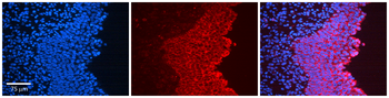 ABL1 Rabbit Polyclonal Antibody