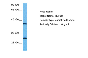 RSPO1 Rabbit Polyclonal Antibody