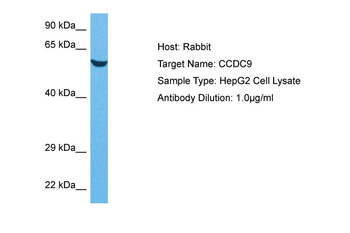 CCDC9 Rabbit Polyclonal Antibody