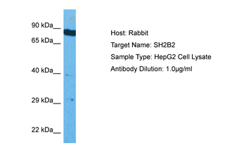 SH2B2 Rabbit Polyclonal Antibody