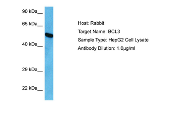 BCL3 Rabbit Polyclonal Antibody