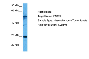 FASTK Rabbit Polyclonal Antibody