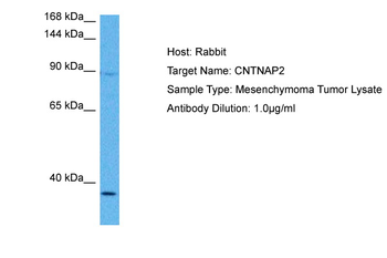 CNTNAP2 Rabbit Polyclonal Antibody