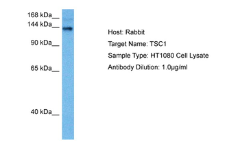 TSC1 Rabbit Polyclonal Antibody