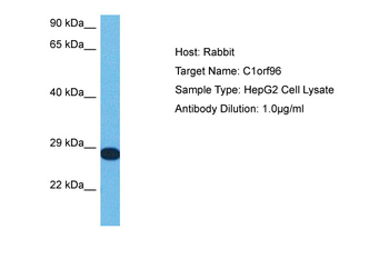 CCSAP Rabbit Polyclonal Antibody