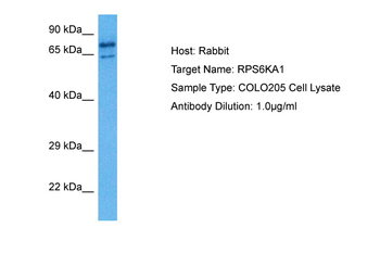RPS6KA1 Rabbit Polyclonal Antibody