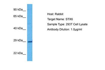 STX6 Rabbit Polyclonal Antibody