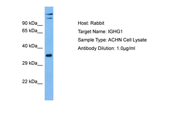 IGHG1 Rabbit Polyclonal Antibody