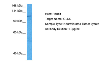 GLDC Rabbit Polyclonal Antibody