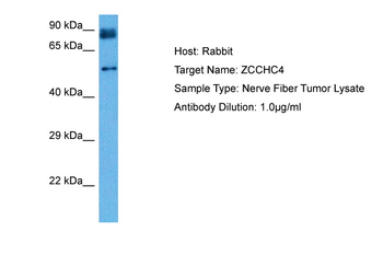 ZCCHC4 Rabbit Polyclonal Antibody