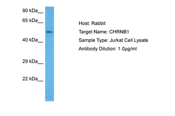 CHRNB1 Rabbit Polyclonal Antibody
