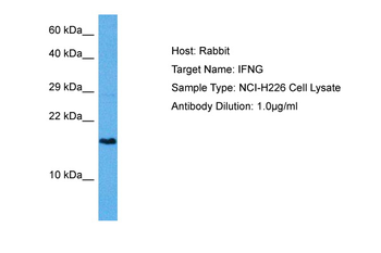 IFNG Rabbit Polyclonal Antibody