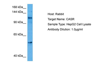 CASR Rabbit Polyclonal Antibody