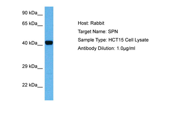 SPN Rabbit Polyclonal Antibody