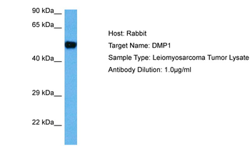 DMP1 Rabbit Polyclonal Antibody