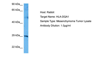 HLA-DQA1 Rabbit Polyclonal Antibody