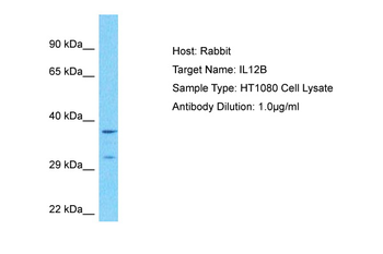IL12B Rabbit Polyclonal Antibody