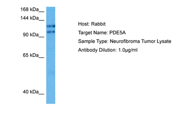PDE5A Rabbit Polyclonal Antibody