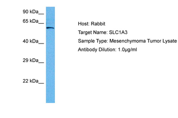 SLC1A3 Rabbit Polyclonal Antibody