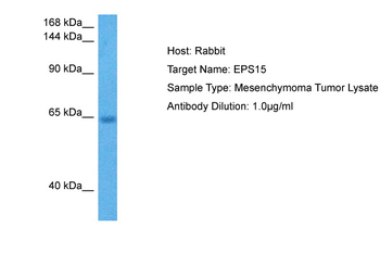 EPS15 Rabbit Polyclonal Antibody