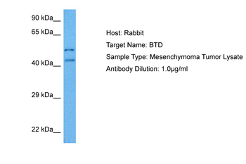 BTD Rabbit Polyclonal Antibody