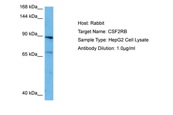 CSF2RB Rabbit Polyclonal Antibody