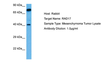 RAD17 Rabbit Polyclonal Antibody