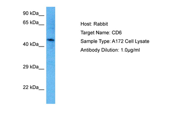 CD6 Rabbit Polyclonal Antibody