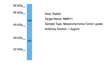 MMP11 Rabbit Polyclonal Antibody