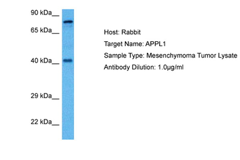 APPL1 Rabbit Polyclonal Antibody