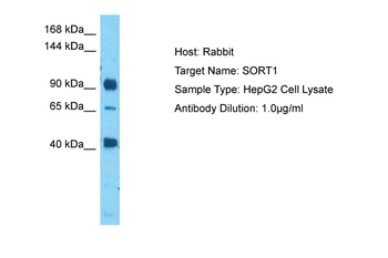 SORT1 Rabbit Polyclonal Antibody
