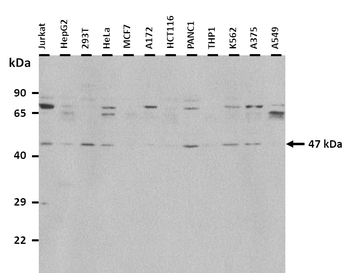 LTBR Rabbit Polyclonal Antibody