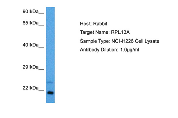 RPL13A Rabbit Polyclonal Antibody