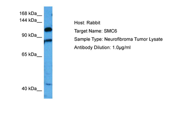 SMC6 Rabbit Polyclonal Antibody