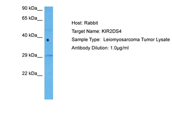 KIR2DS4 Rabbit Polyclonal Antibody
