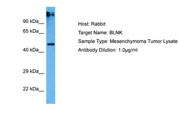 BLNK Rabbit Polyclonal Antibody