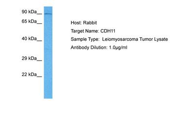CDH11 Rabbit Polyclonal Antibody